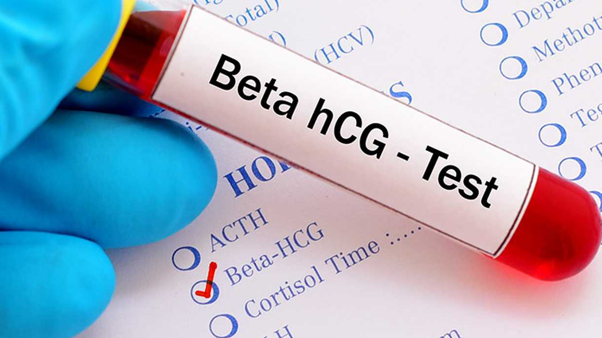 2 haftalık gebelikte Beta HCG değeri kaç olmalı?