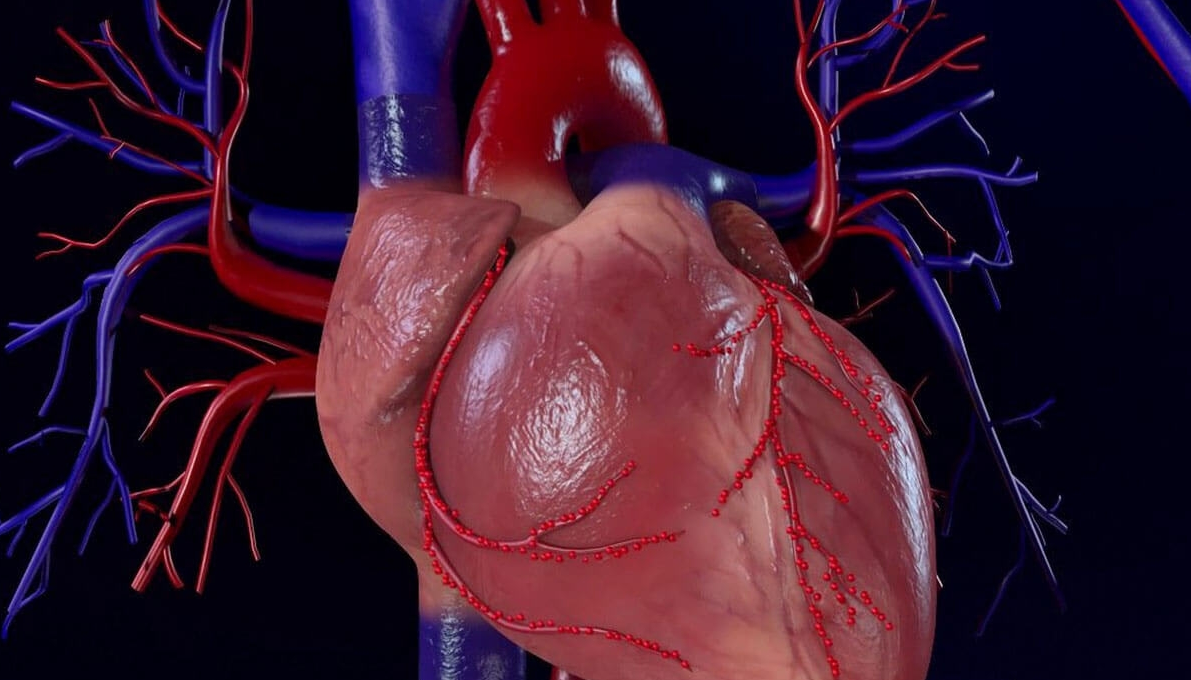 Koroner Arter Kalp Hastalığı Nedir, Belirtileri Nelerdir