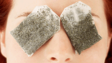 Göz Altı Morluklarına Doğal Çözümlerle Etkili Yöntemler