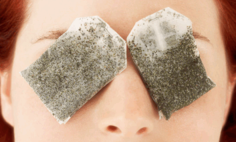 Göz Altı Morluklarına Doğal Çözümlerle Etkili Yöntemler